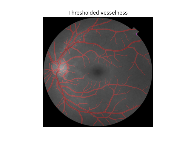 Thresholded vesselness